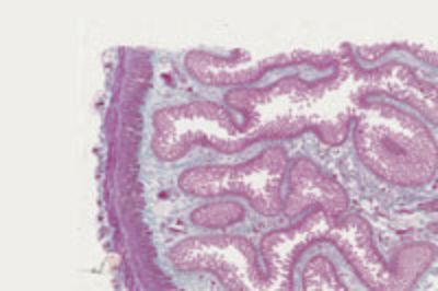 Ejemplo de tejido visualizado a través de microscopía virtual