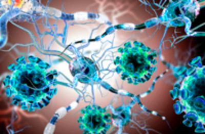 La investigación premiada en la categoría Investigador Joven, estudia la proteostasis neuronal en diferentes enfermedades cerebrales asociadas al envejecimiento.