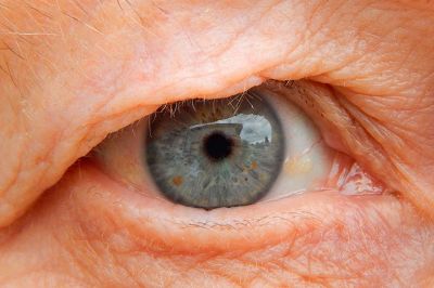 Con esta video guía educativa, las personas pueden conocer más detalles de esta patología que afecta a la zona central del ojo.