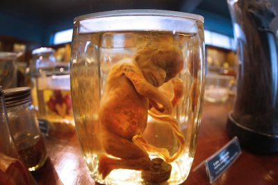 Es posible ver cuadros, figuras, cuerpos humanos conservados por años, fetos que muestran defectos congénitos. 