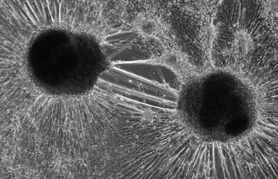 Las académicas del Departamento de Biología de la Facultad de Ciencias de la Universidad de Chile, estudiaron cómo se establecería la conectividad funcional de las neuronas mediante células madres pluripotentes inducidas (hIPSC).