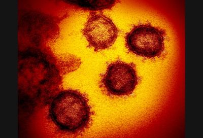 La aparición de este nuevo virus ha generado un desafío único para el mundo científico alrededor del mundo. 